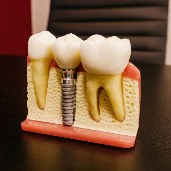 dentes proteses