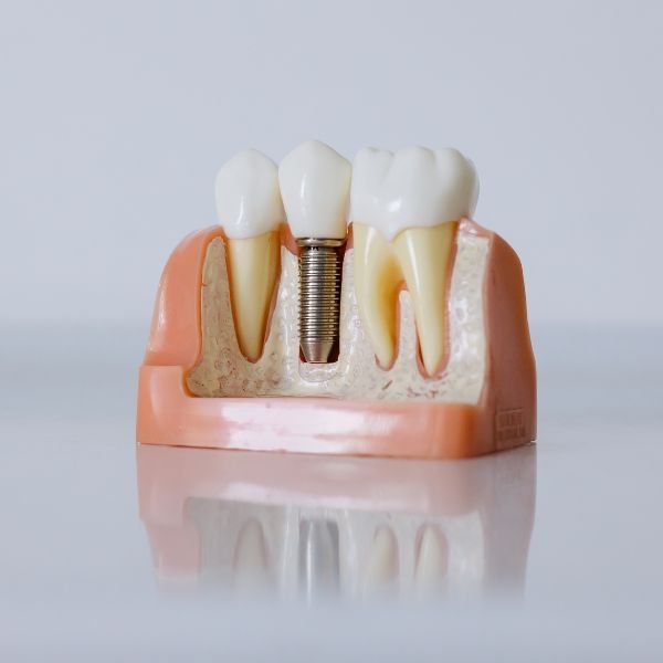 dentes proteses
