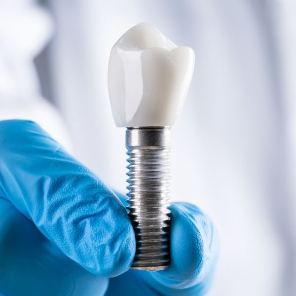 dentes proteses